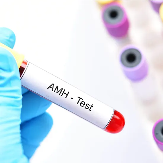 Antimullerian Hormone (AMH) Plus